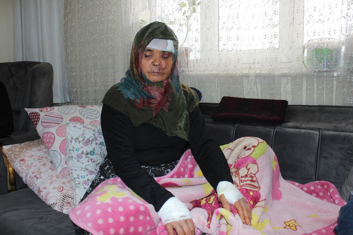 aksarayda yasli cift kizlarinin kopeginin saldirisina ugradi 0 u2XE18zF