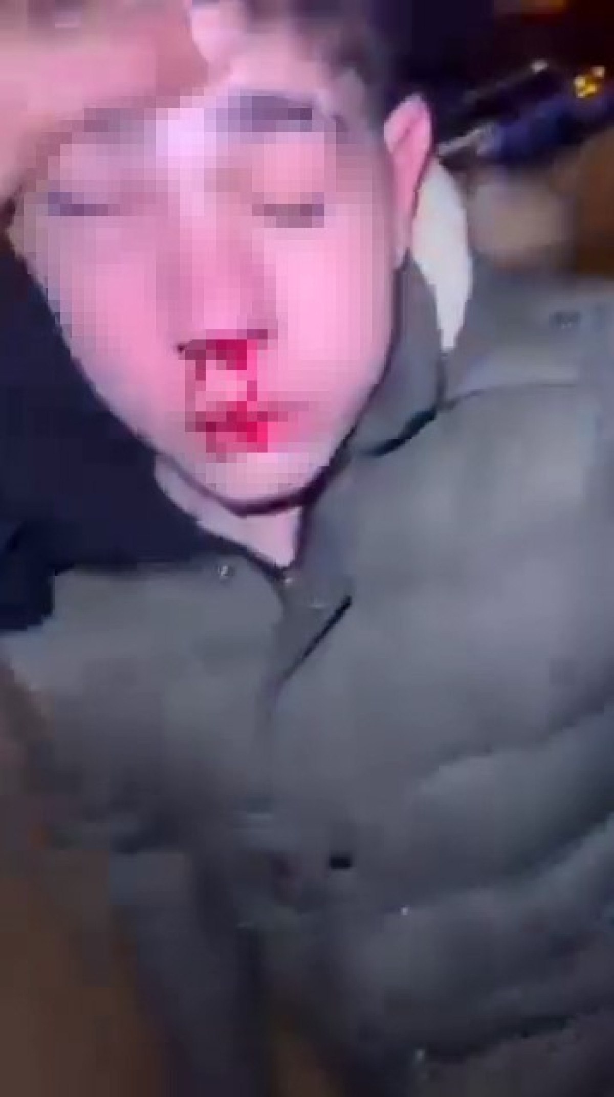 istanbulda engelli cocuga iskence yapip kayda aldilar 3