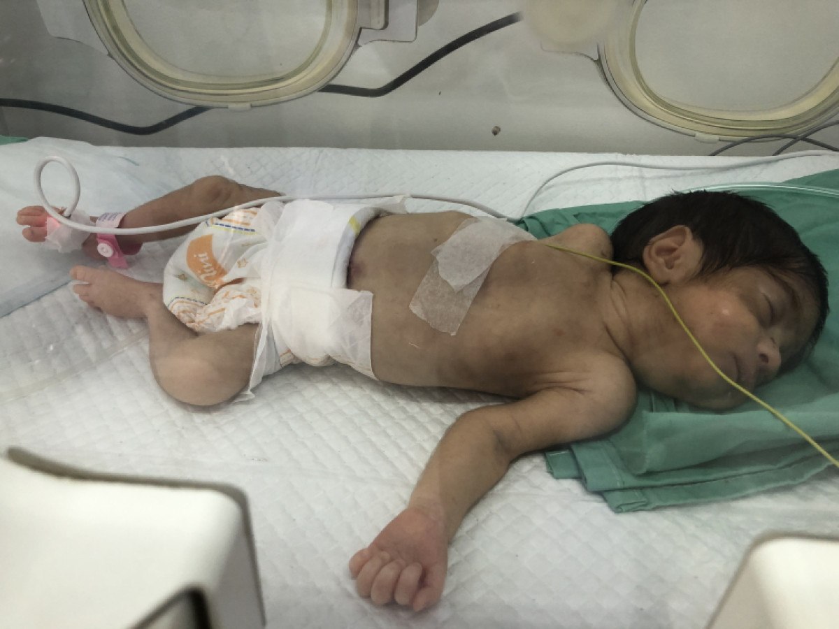 israil saldirisi altinda olan gazzede oksijen sikintisi hasta bebeklerin hayati tehlikede 2 JdXE8ilW