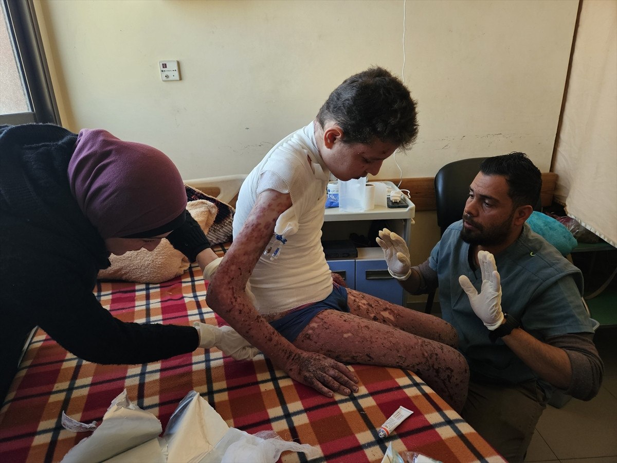 nadir cilt hastasi gazzeli cocuk saldirilar nedeni ile tedavi olamiyor 21