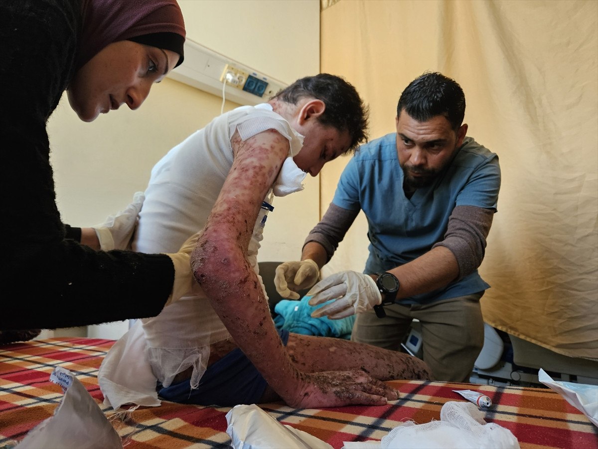 nadir cilt hastasi gazzeli cocuk saldirilar nedeni ile tedavi olamiyor 23