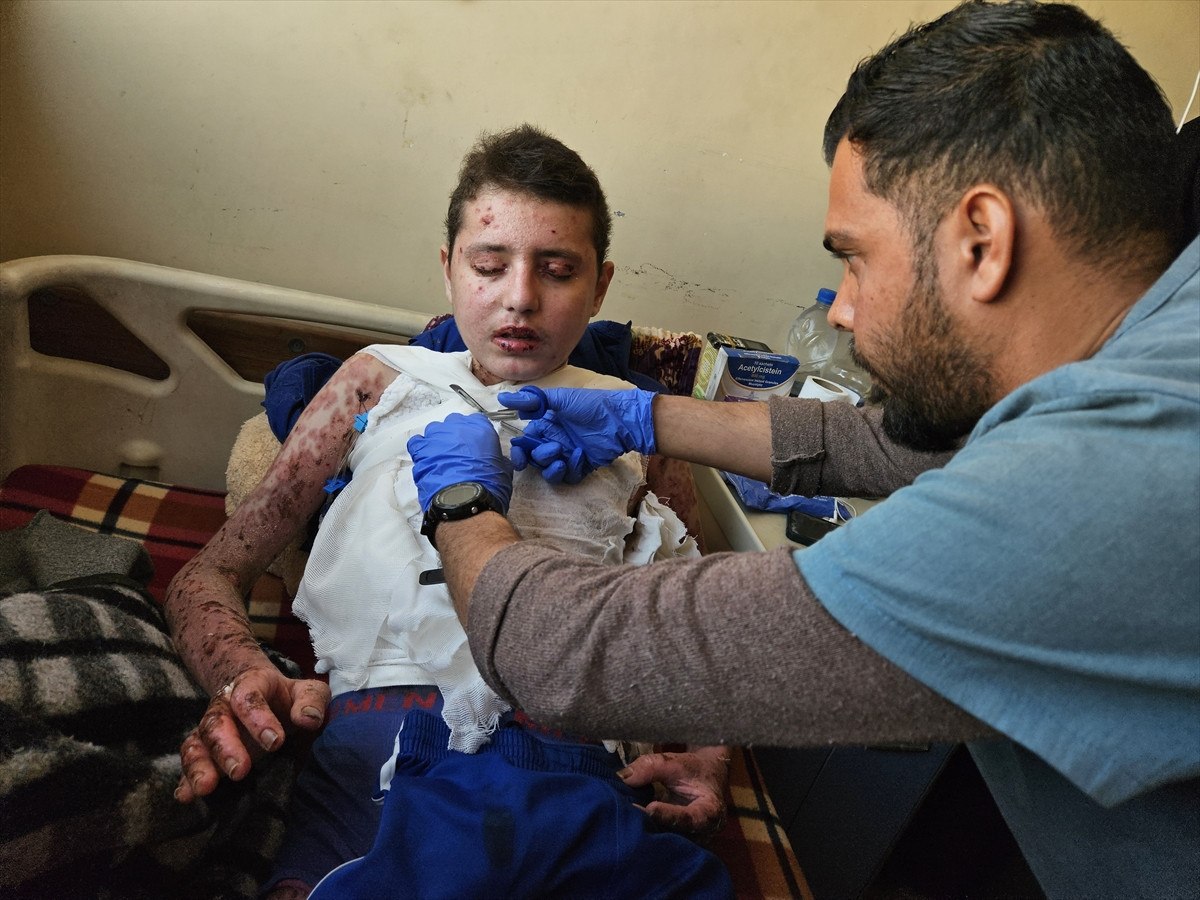 nadir cilt hastasi gazzeli cocuk saldirilar nedeni ile tedavi olamiyor 7 vLCZ948Z